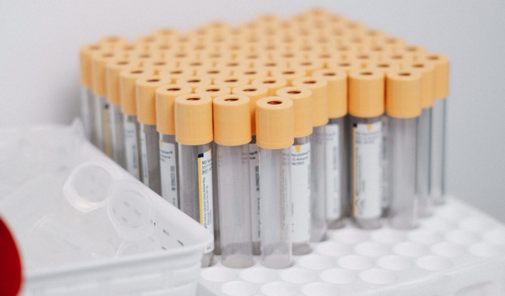 Laboratory tests | Puls Centrum, Prague 1